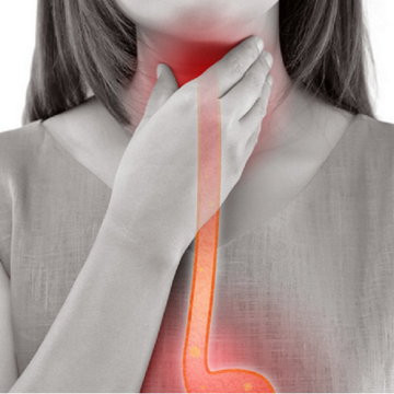 Achalasia 5265848 1280